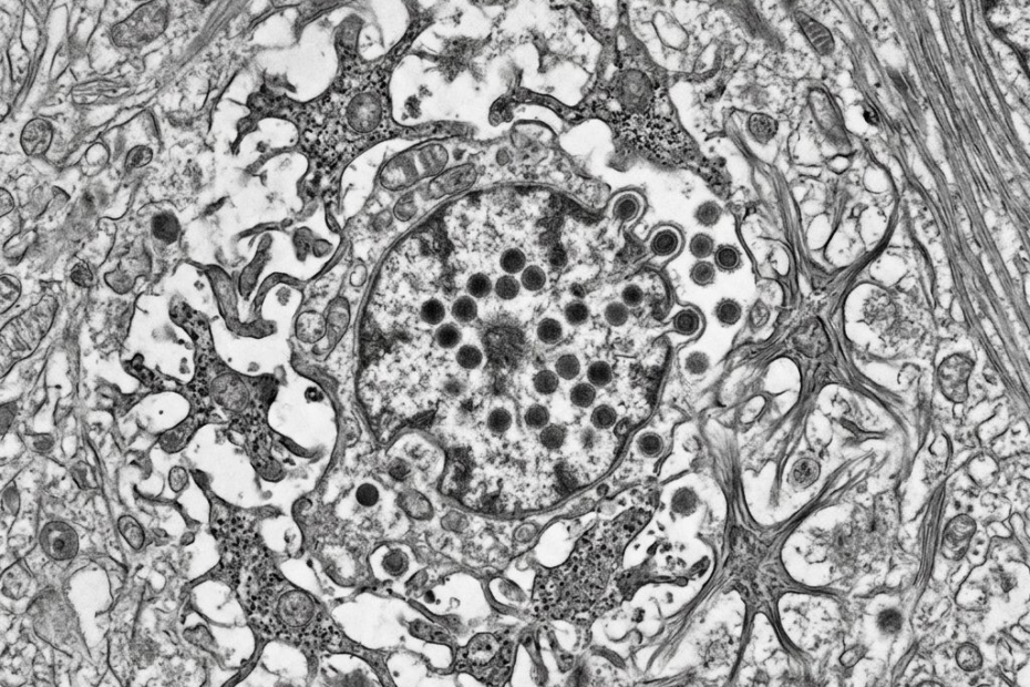 Kad herpes stigne do mozga: imune ćelije mijenjaju prioritete